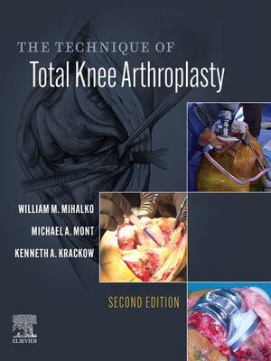 cover image of The Technique of Total Knee Arthroplasty E-Book